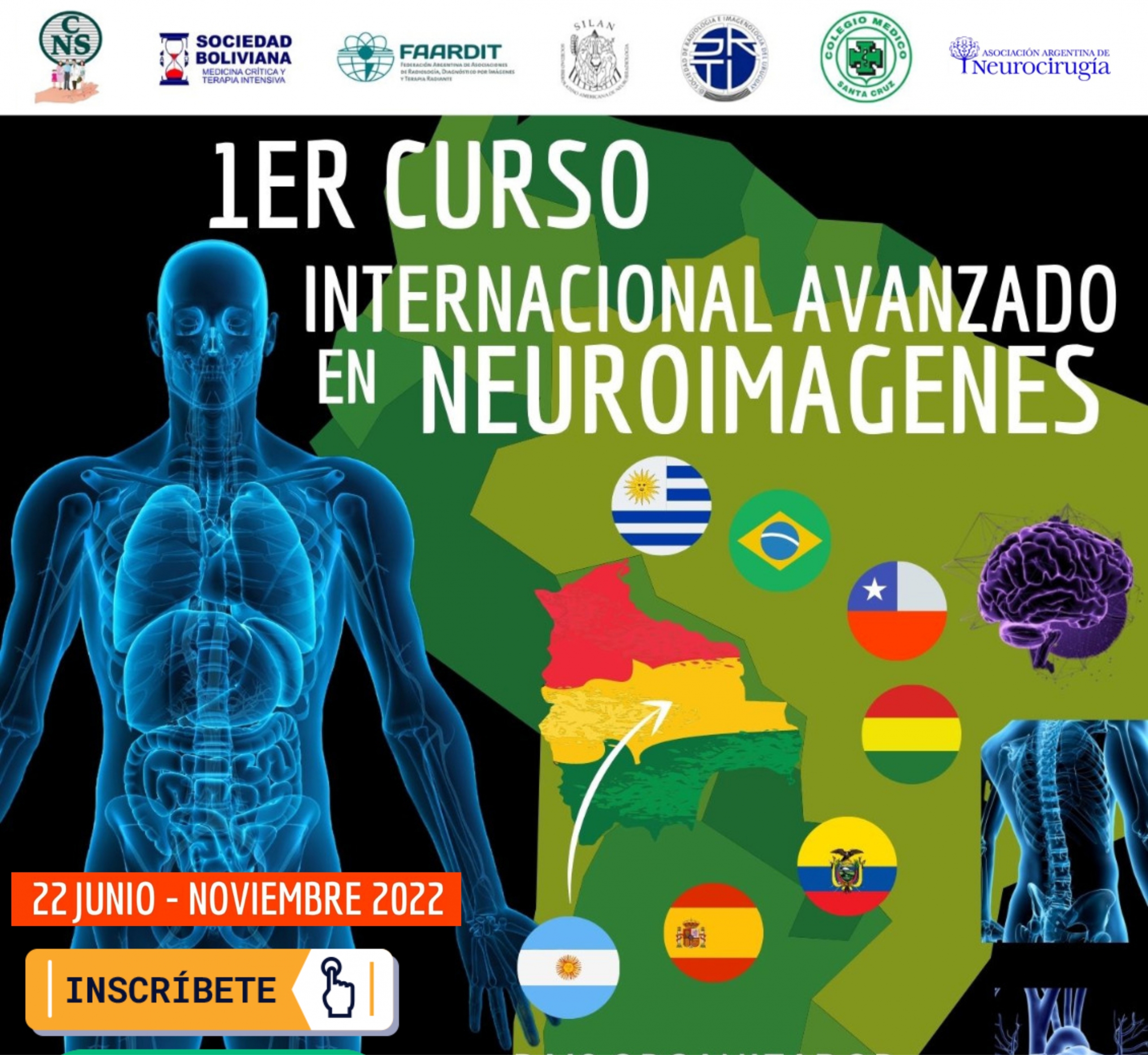 1° Curso Internacional Avanzado en Neuroimagenes